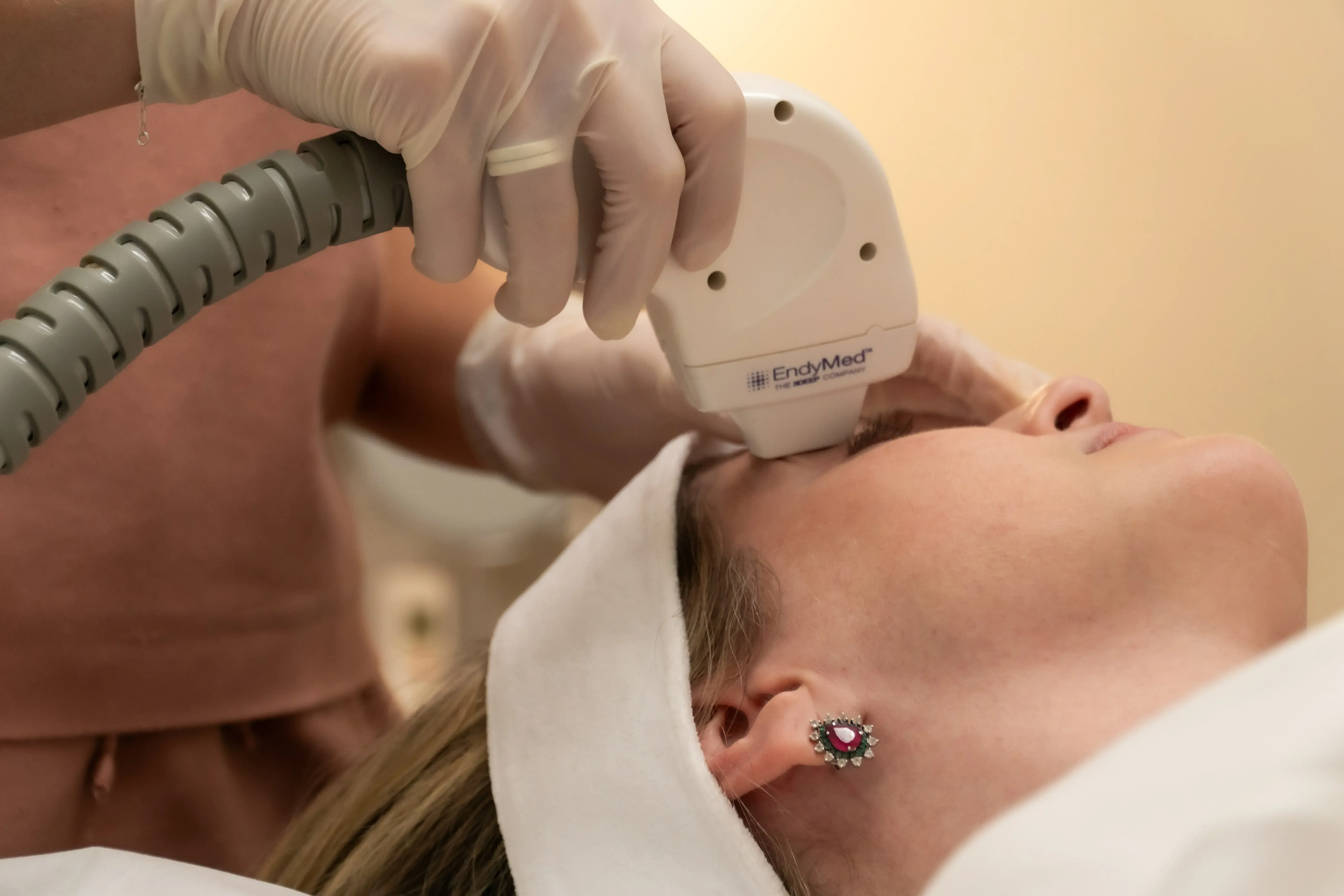 Tratamento para Flacidez Palpebral - Perda de firmeza e sustentação na região periorbital